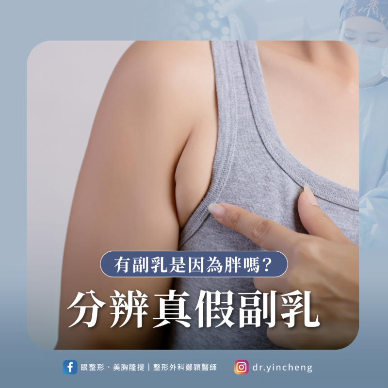 如何分辨真假副乳