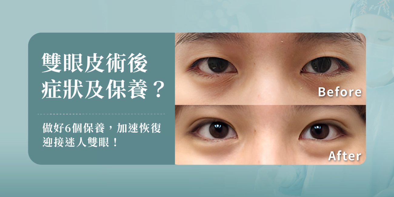 雙眼皮手術術後常見的併發症症狀與6個術後保養方法