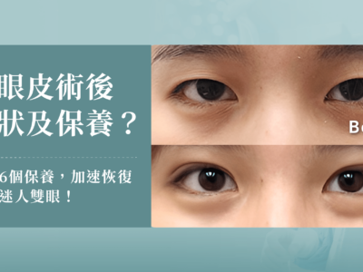 雙眼皮手術術後常見的併發症症狀與6個術後保養方法