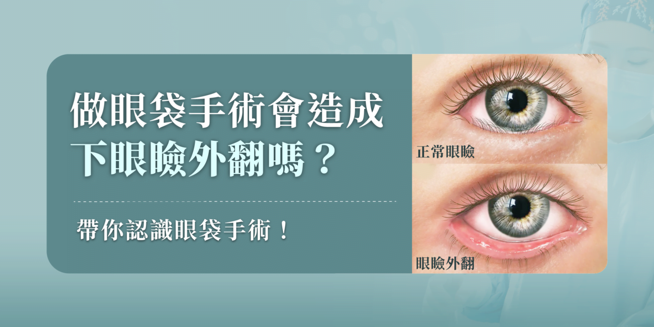 做眼袋手術會造成下眼瞼外翻嗎?