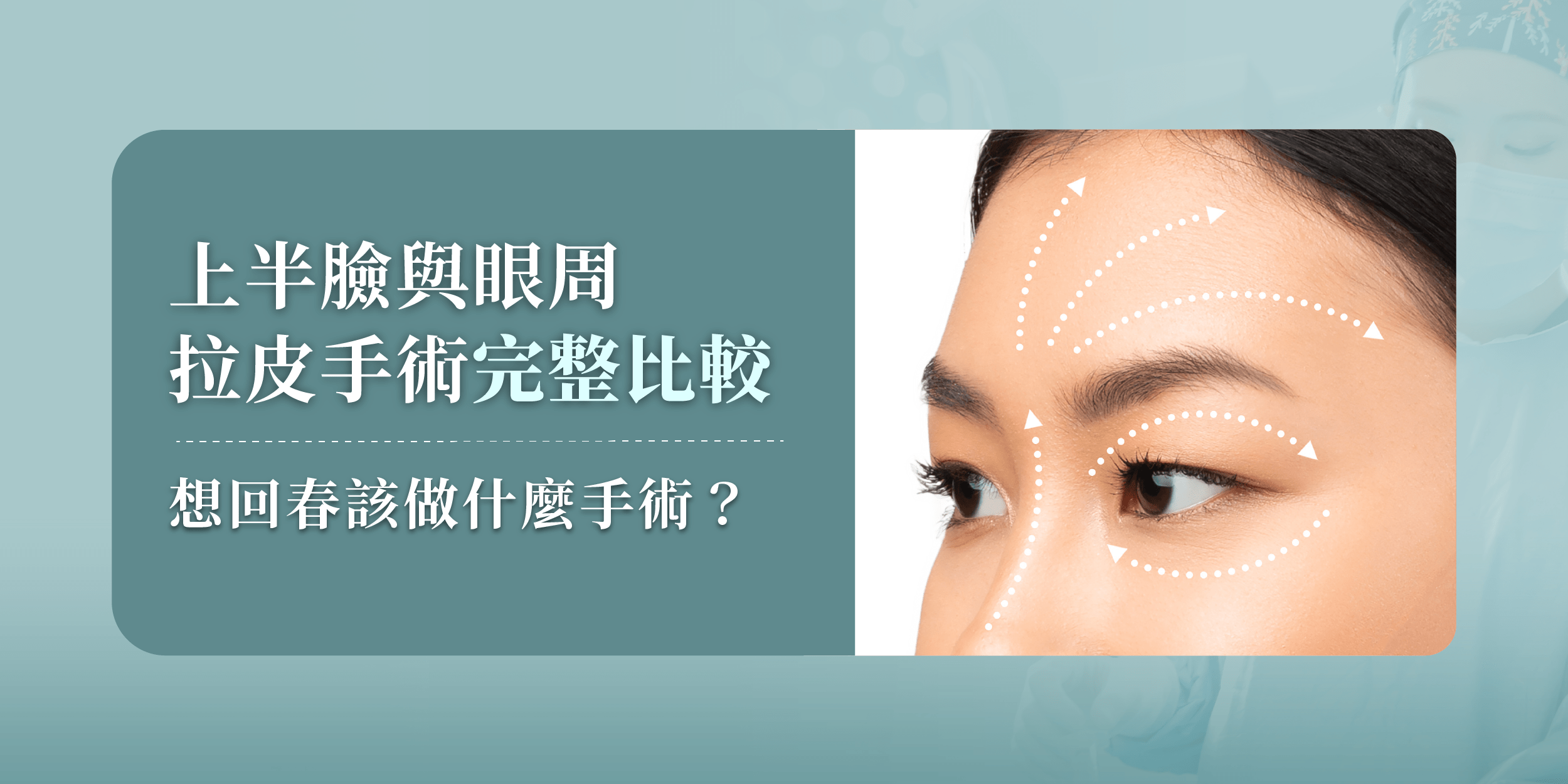 想回春該做什麼手術?完整比較各種上半臉與眼周拉皮手術的差異