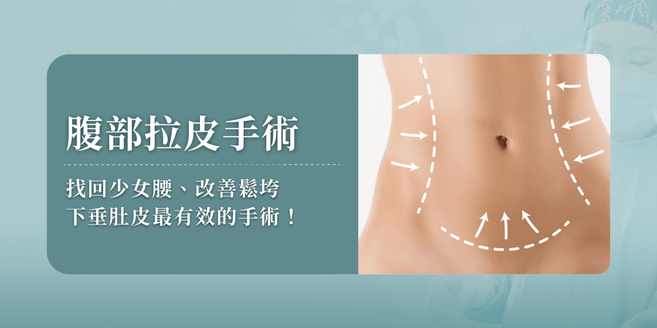 腹部拉皮手術—找回少女腰、改善鬆垮下垂肚皮最有效的手術！