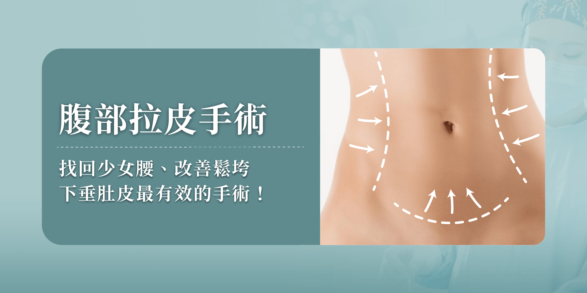 腹部拉皮手術—找回少女腰、改善鬆垮下垂肚皮最有效的手術!