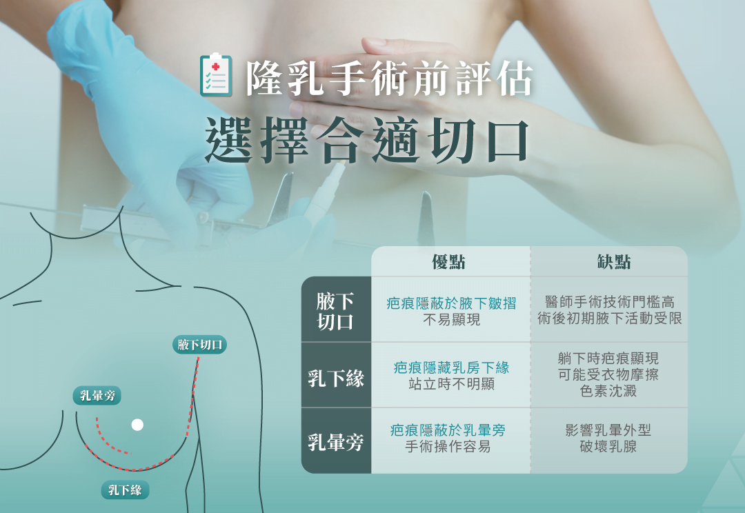 隆乳手術 周全性評估